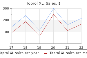 toprol xl 50 mg visa
