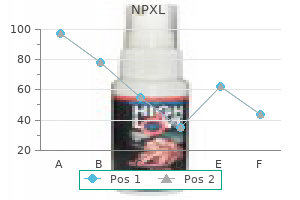 buy npxl us